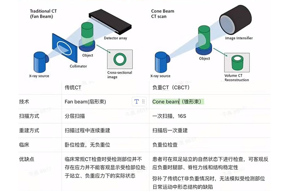 負重CT和傳統CT有何不同?